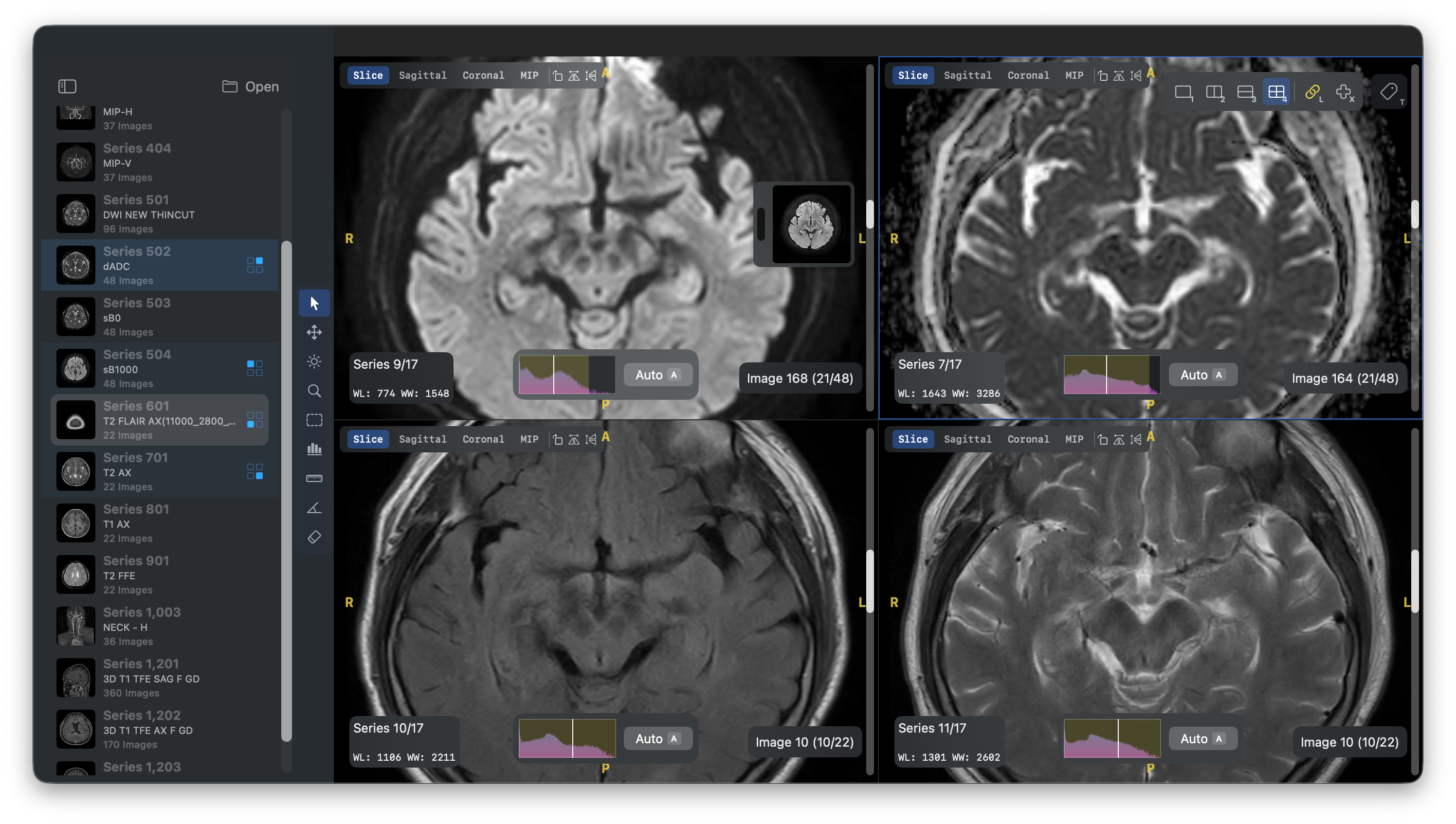 OpenDicomViewer — multi-panel DICOM viewer with MPR reconstruction